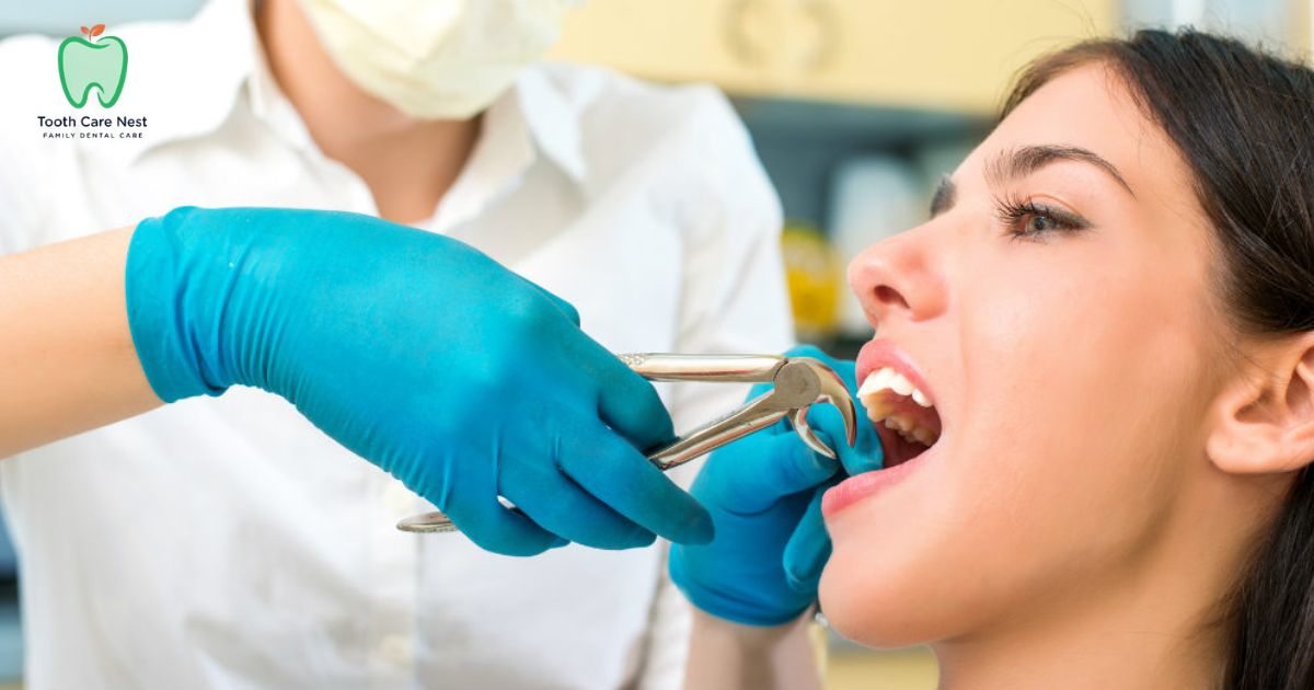 Tooth Extraction