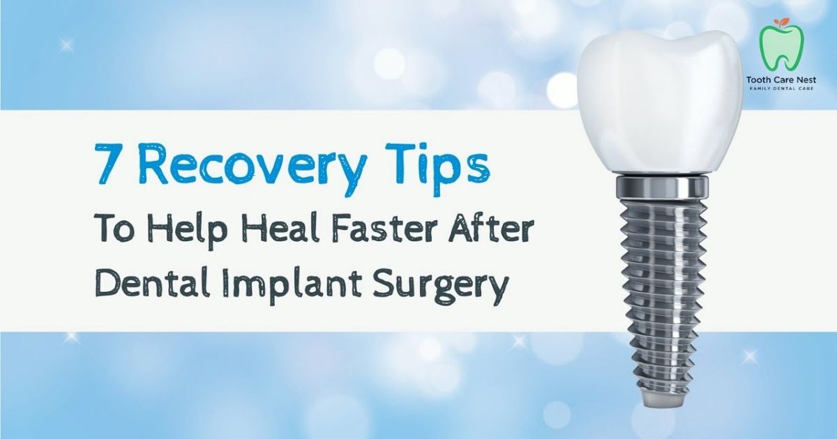 recover from Dental Implant Surgery