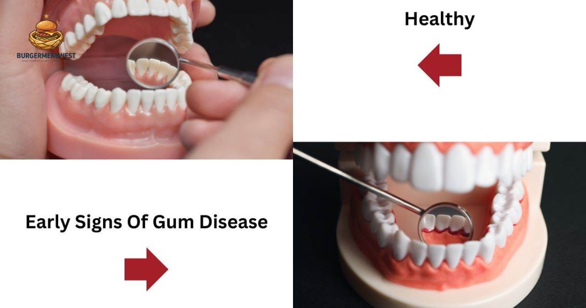 How Dentists Diagnose Gum Disease