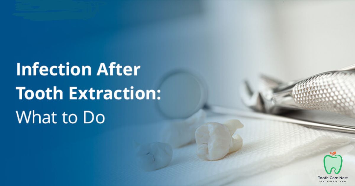 Infection After Tooth Extraction