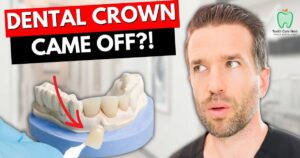 My Crown Fell Out