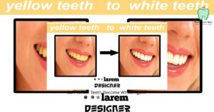 Can Yellow Teeth Become White Again?